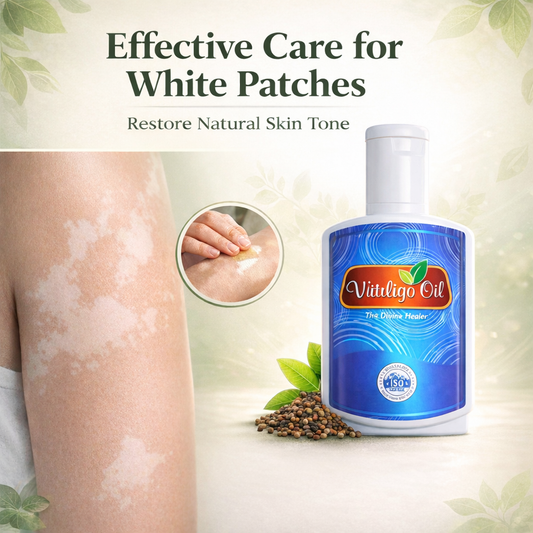 Witinligo Oil ( vitiligo )