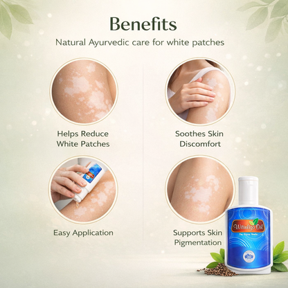 Witinligo Oil ( vitiligo )