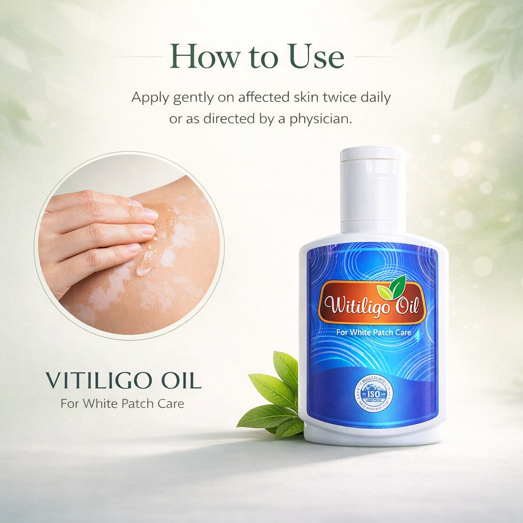Witinligo Oil ( vitiligo )