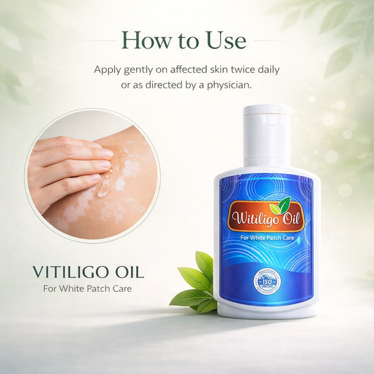Witinligo Oil ( vitiligo )